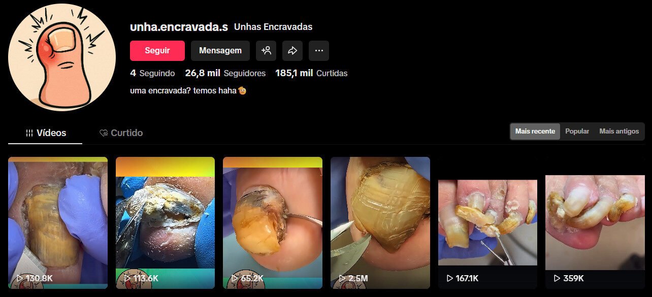 TikTok à venda – unhas encravadas | 26 mil seguidores